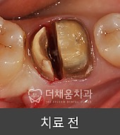 치료전사진